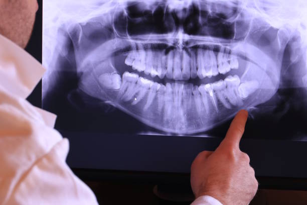 Best Walk-In Emergency Dentist in Newport, NC