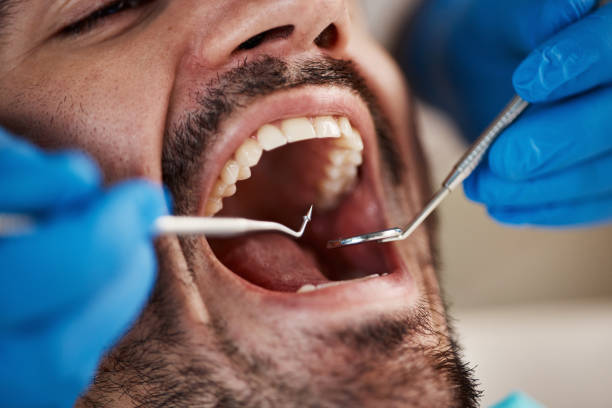 Best Emergency Tooth Extraction in Newport, NC